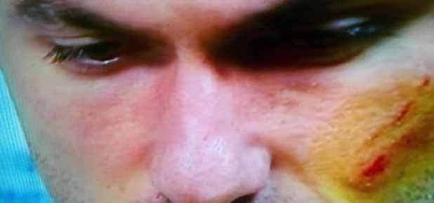 Çaykur Rizespor’dan Burak açıklaması